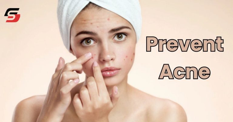 Prevent Acne