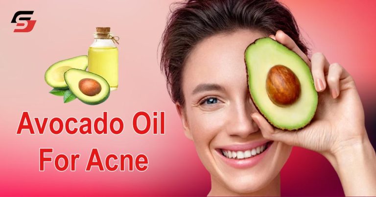 Avocado Oil For Acne