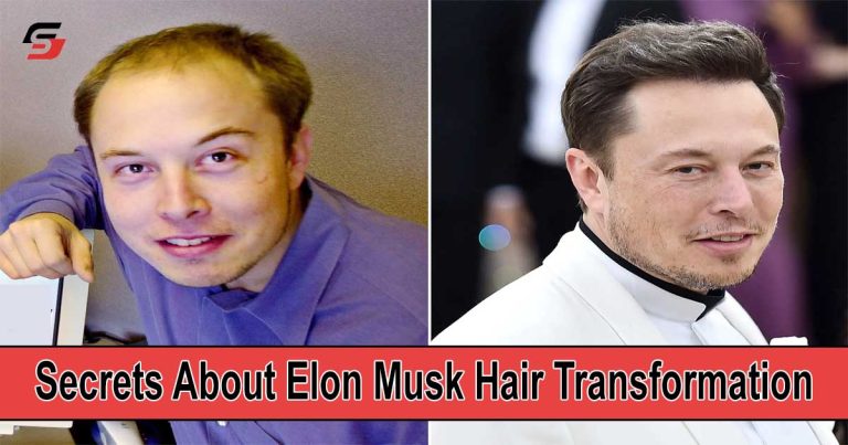 Secrets About Elon Musk's Hair Transformation