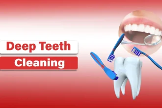 Deep Teeth Cleaning