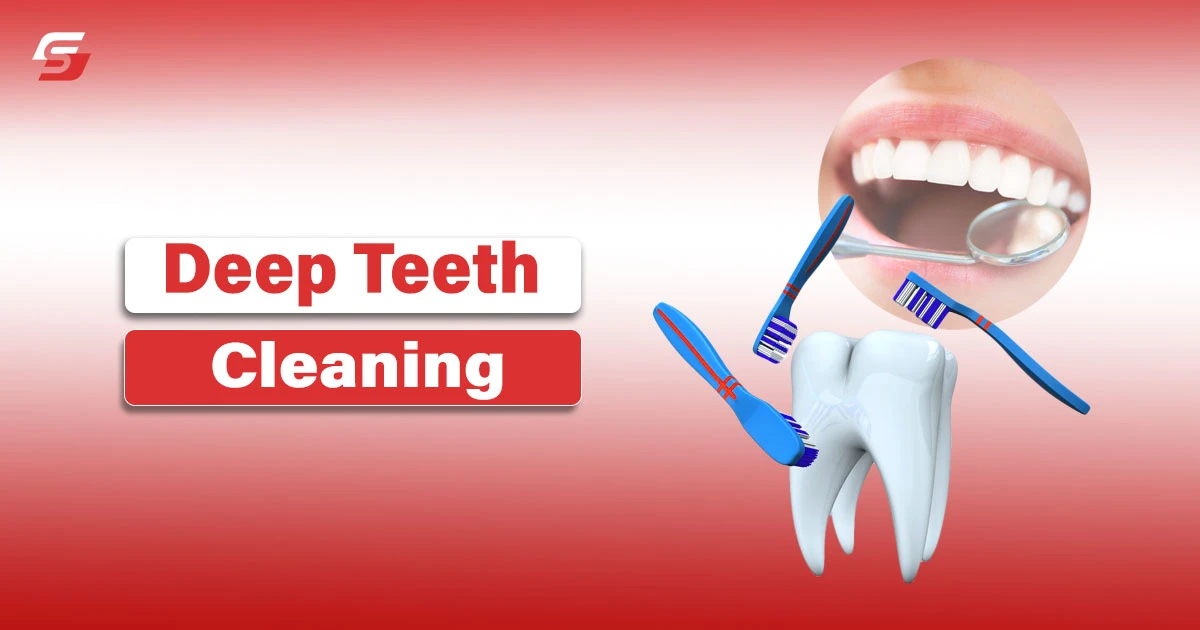 Deep Teeth Cleaning