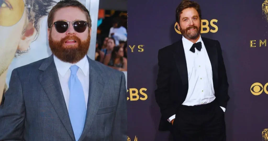 Zach Galifianakis