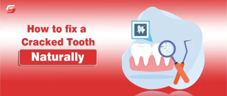 Toothbrush and natural oral care ingredients arranged neatly and find how to fix a cracked tooth naturally.