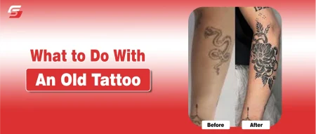 What to Do With an Old Tattoo